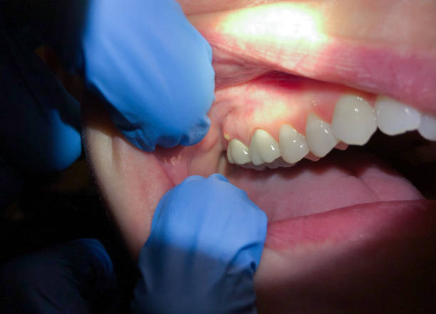 Best Emergency Dental Clinic in VT
